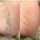 LOVASKIN INSTANT FOOT PEEL - Flacon pulvérisateur 75 ml - 25 traitements dans un seul flacon