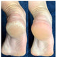 LOVASKIN INSTANT FOOT PEEL Discovery Kit - Over 10 Beauty pedicure treatments